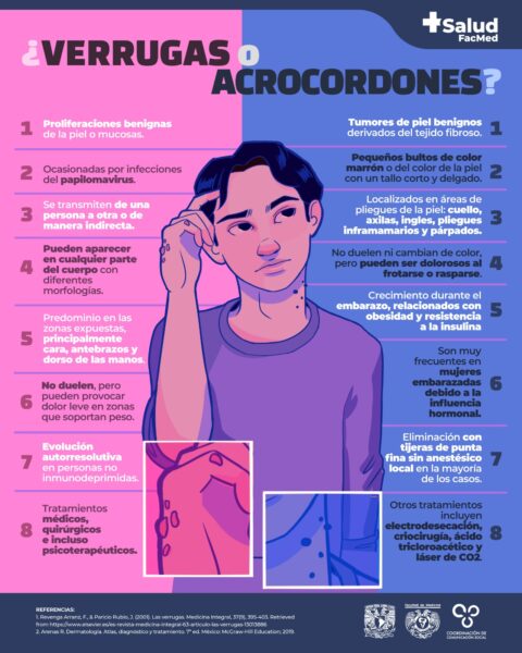 Verrugas O Acrocordones Salud FacMed