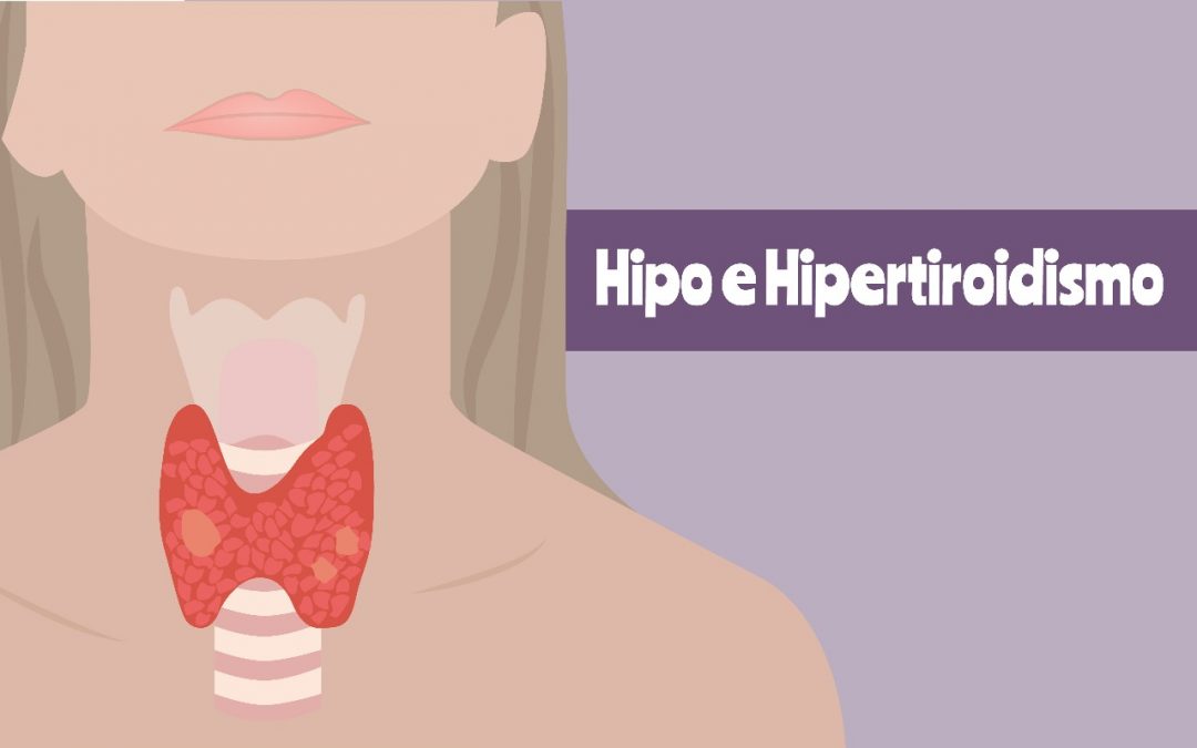 Hipo e hipertiroidismo