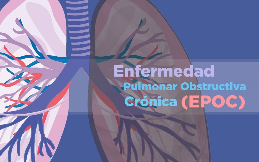 Fumar: la principal causa de EPOC