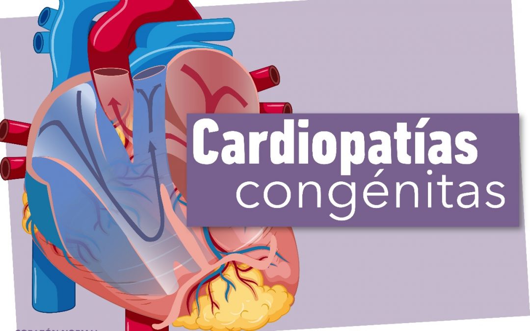Cardiopatías congénitas
