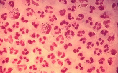 Gonorrea, otra de las enfermedades silenciosas