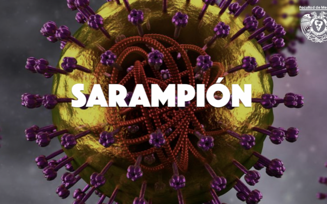 Lo que debes saber sobre el sarampión