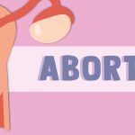 ¿Qué es el aborto?
