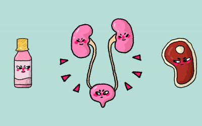 ¿Cálculos en los riñones?