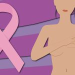 Fisioterapia en el cáncer de mama