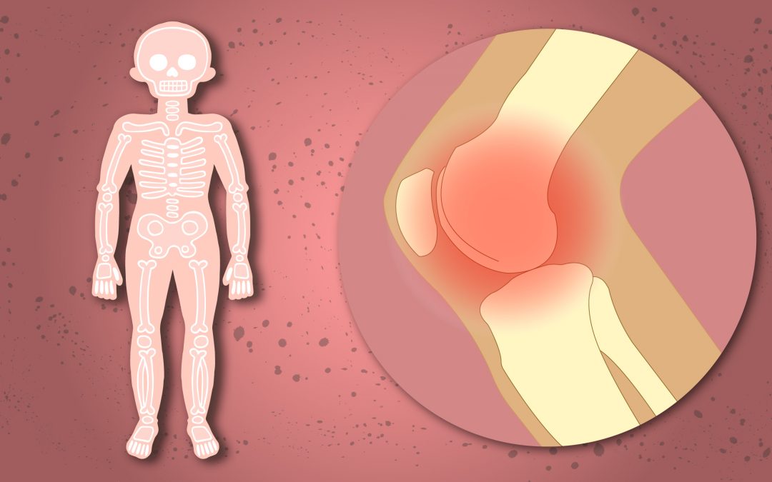 Luxaciones y fisioterapia