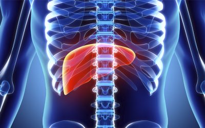 Insuficiencia Hepática Crónica (Cirrosis)