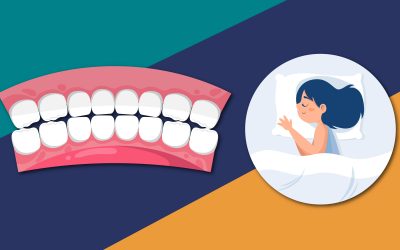 ¿Tienes el hábito de rechinar los dientes?