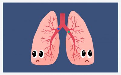 ¿Qué es la Neumonía Adquirida en la Comunidad?