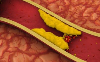 ¿Cómo se clasifica el colesterol y cómo afecta a nuestra salud?