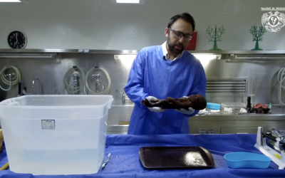 REHIDRATACIÓN DE CUERPOS