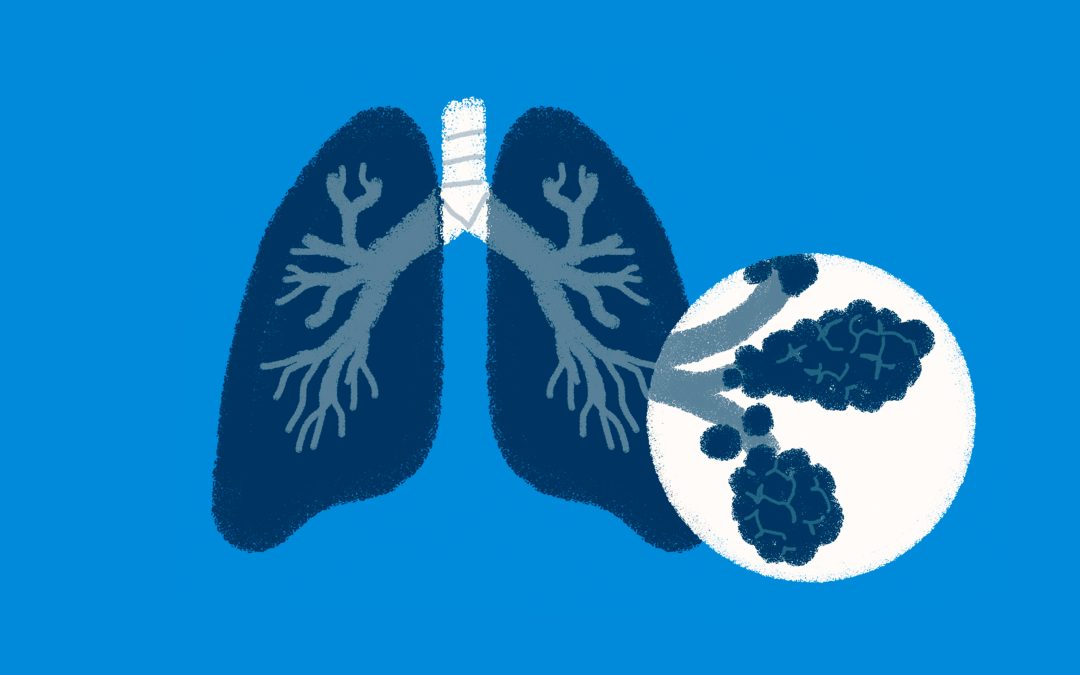 Fibrosis Quística