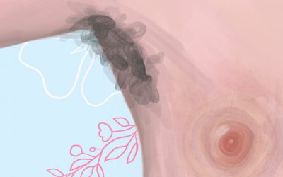 ¿Los hombres también padecen cáncer de mama?