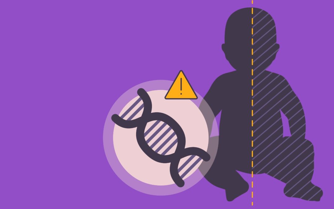 ¿Qué es la hemiplegia alternante de la infancia?