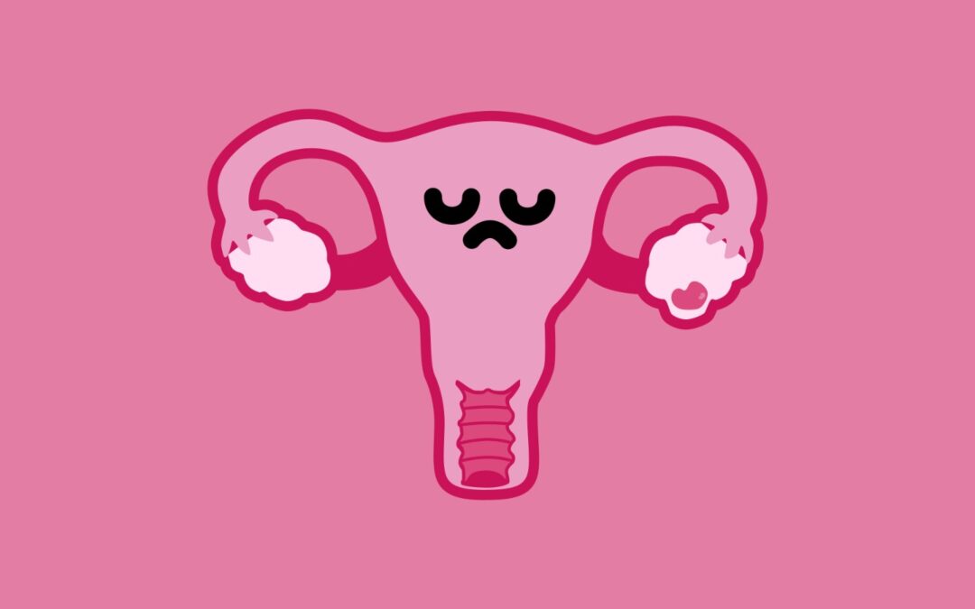 Cáncer de ovario: síntomas y factores de riesgo