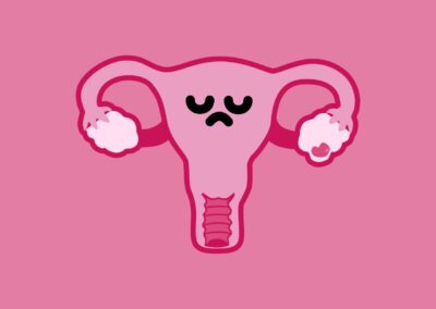 Cáncer de ovario: síntomas y factores de riesgo