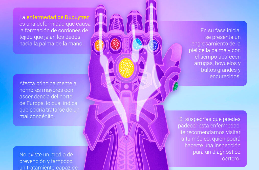 ¿CONOCES LA ENFERMEDAD DE DUPUYTREN?