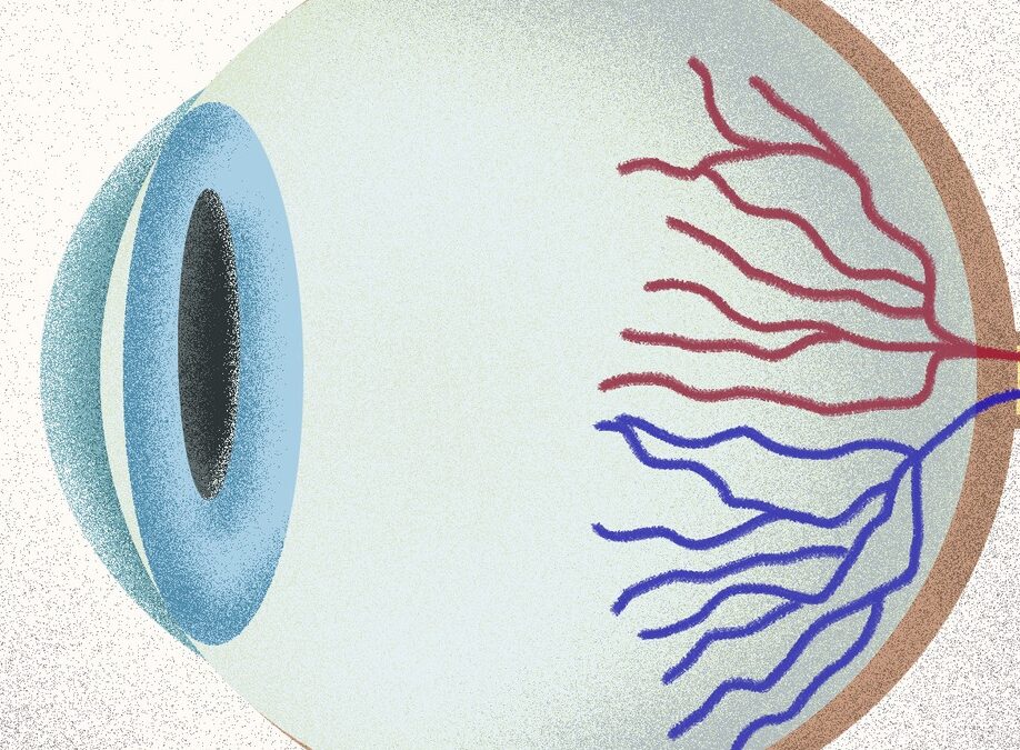 Día nacional del glaucoma